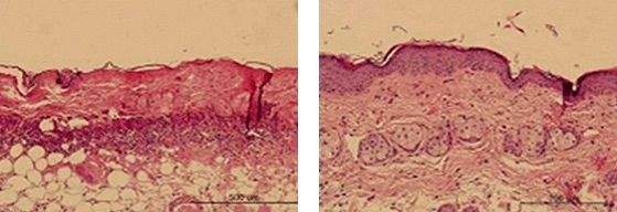 Princeton healite before and after - microscopic view of skin